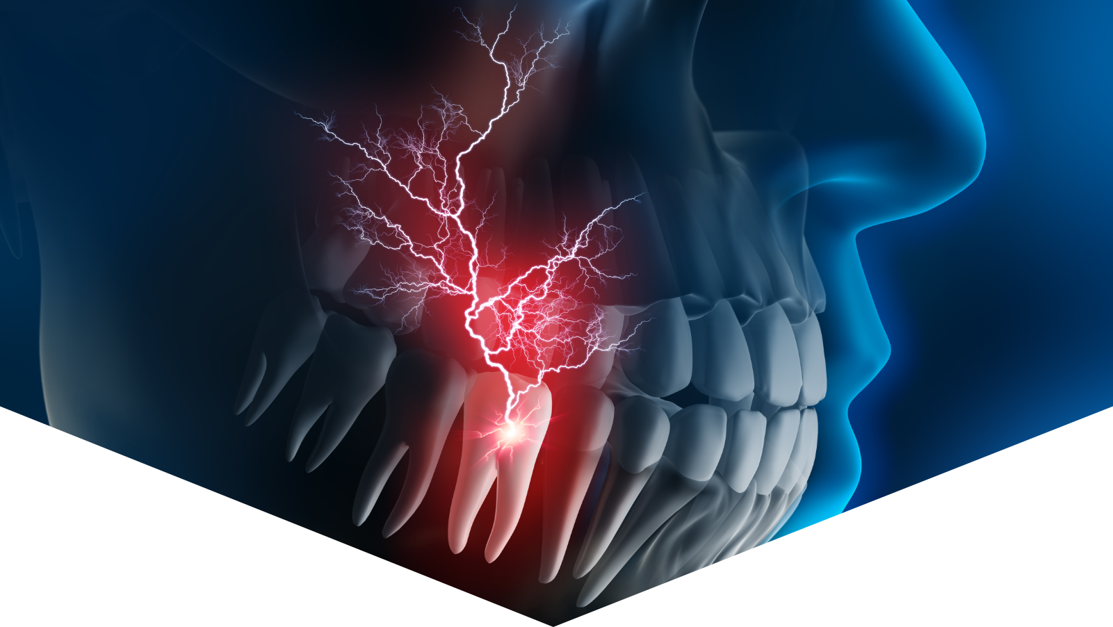 Endodonzia